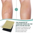 thumbnail image 3 of 2025 Varicose Veins Treatments Stickers Universal Varicose Massage Stickers for Loose Leg Vein Legs, 3 of 5