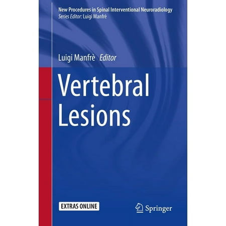 UPC: 9783319526324 | New Procedures in Spinal Interventional Neuroradiology: Vertebral Lesions (Paperback)