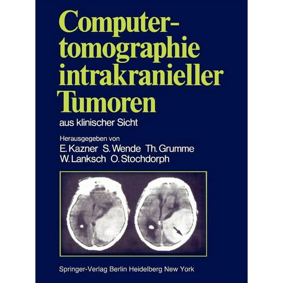 Computertomographie Intrakranieller Tumoren Aus Klinischer Sicht, (Paperback)