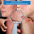 thumbnail image 4 of SPODARE Mascarilla labial para dormir manzana verde - Reparación para labios secos y agrietados Cuidado de vitamina C más suave Nutre y revitaliza tus labios durante la noche con manteca de karité - 0, 4 of 5