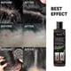 thumbnail image 5 of Anti-dandruff And Anti-itch Shampoo Deep Cleansing And Anti-itch Shampoo Refreshing And Anti-oil Shampoo, 5 of 5