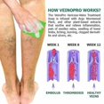 thumbnail image 3 of Veinopro Varicose-veins Treatment Soap Wormwood Soap Promote Blood Circulation, 3 of 5