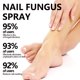 thumbnail image 2 of Spray para hongos en las uñas - Cuidado desodorizante para uñas grises e infecciones por hongos, 100 ml, 2 of 4