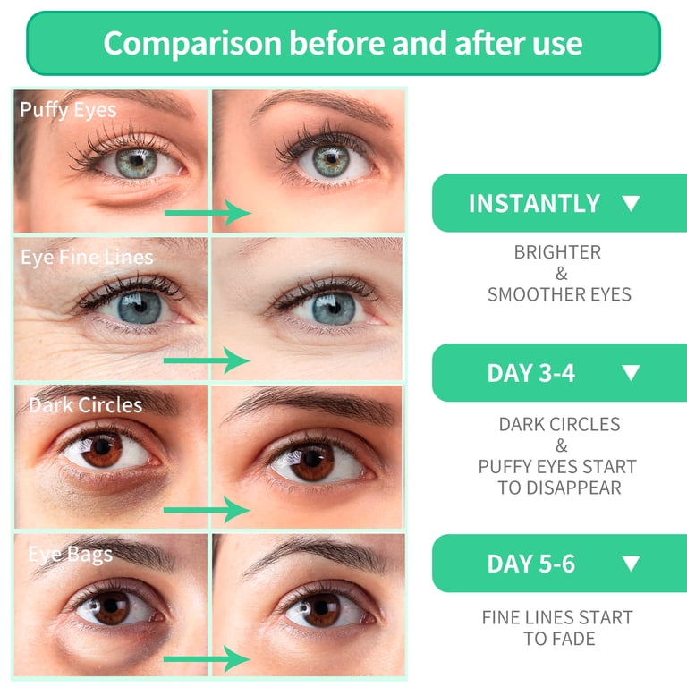 BREYLEE Natural Aloe Vera Eye Mask, 30 Pairs, Anti-Wrinkle Face Care for  Dark Circles and Puffiness