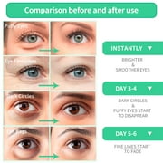 BREYLEE Natural Aloe Vera Eye Mask, 30 Pairs, Anti-Wrinkle Face Care for Dark Circles and Puffiness