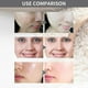 thumbnail image 4 of OUHOE Facial Exfoliating Gel Deep Cleansing Exfoliated Skin Blackheads and Acne Pores Brightening Rejuvenating Gel | |-3770648196386, 4 of 5
