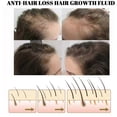thumbnail image 4 of Líquido para el crecimiento del cabello, nutritivo, para el crecimiento de las raíces del cabello, reparador de daños y espesos, con jengibre, líquido para el cuidado del cabello | 3375273874472,2 p, 4 of 5