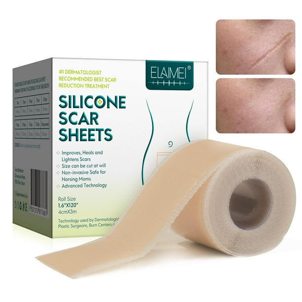 Láminas de silicona para cicatrices (1,6” x 120”, 3M), cinta de silicona para cicatrices, tiras para cicatrices, láminas de silicona para cicatrices efectivas para cicatrices quirúrgicas Sincero Hogar