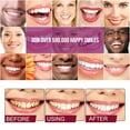 thumbnail image 4 of Tartar Removal Toothpaste,  Probiotic Toothpaste Mild 2pcs 4.2oz Portable  for Travel, 4 of 8
