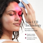 Solawave Bye Acne Spot Treatment - Red & Blue Light Therapy Device for Face & Body - Reduces Redness & Inflammation