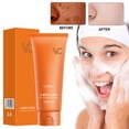 thumbnail image 1 of Fiudx Ofertas flash del día solo en línea Mousse exfoliante de cúrcuma y kójico, aclara, limpia suavemente, cuida la piel, elimina las manchas, blanquea y nutre., 1 of 7