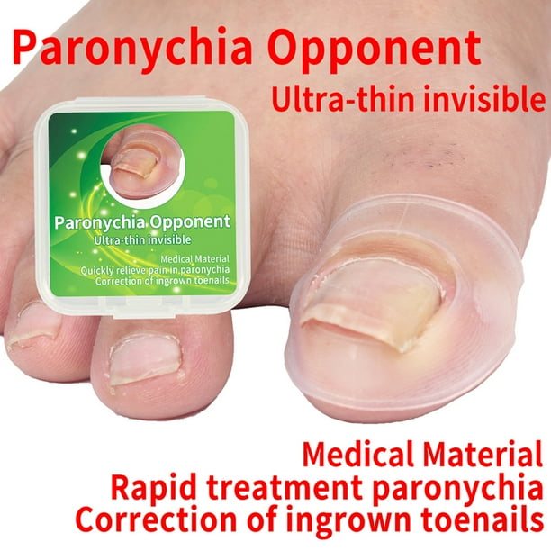 Fugacal Pegatinas de corrección de u?as, 2 piezas Herramienta de cuidado de pies corrector de u?as encarnadas de silicona para paroniquia Recuperación de herramientas de cuidado de u?as curativas Fugacal No se aplica