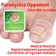 thumbnail image 4 of Corrector De Uñas Encarnadas, Transparente 2 Piezas Conveniente Corrector De Uñas De Los Pies, Para Uñas De Los Pies, 4 of 7