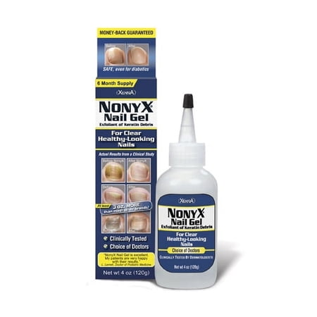 Xenna All Natural Nonyx Nail Gel for Toenails and Finger nails, 4 oz