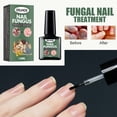 thumbnail image 3 of Líquido para eliminar hongos en las uñas de los pies 15 ml esencia para uñas hongos en las uñas de los pies cuidado de los pies y las manos, 3 of 9