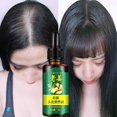 thumbnail image 4 of Sueros para el crecimiento del cabello de jengibre Detener la pérdida de cabello Tratamiento para el adelgazamiento del cabello Aceite para el crecimiento del cabello para mujeres kaili Sencillez, 4 of 4