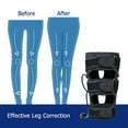 thumbnail image 3 of Corrective Leg Bandage Foot Care Tools O Form X Form Legs Correction Belt Correction Band, 3 of 8
