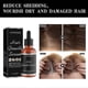 thumbnail image 4 of Jaysuing Dense Hair Essence Strong And Tough Hair Fixing Hair Root Thick Hairline Moisturizing Hair In Stock - 29Ml, 4 of 5