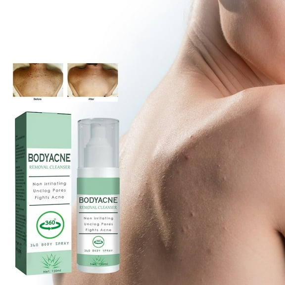 CozyQx Cheap! Body Removing Cleaning Spray Deeply Cleans Back And Arms To And Moisturizing Spray 120ml