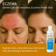 thumbnail image 6 of CLINITY Psoriasis & Eczema Shampoo, Hair & Scalp Treatment with Copper, Honey, and Coptis, 12 fl oz, 6 of 9