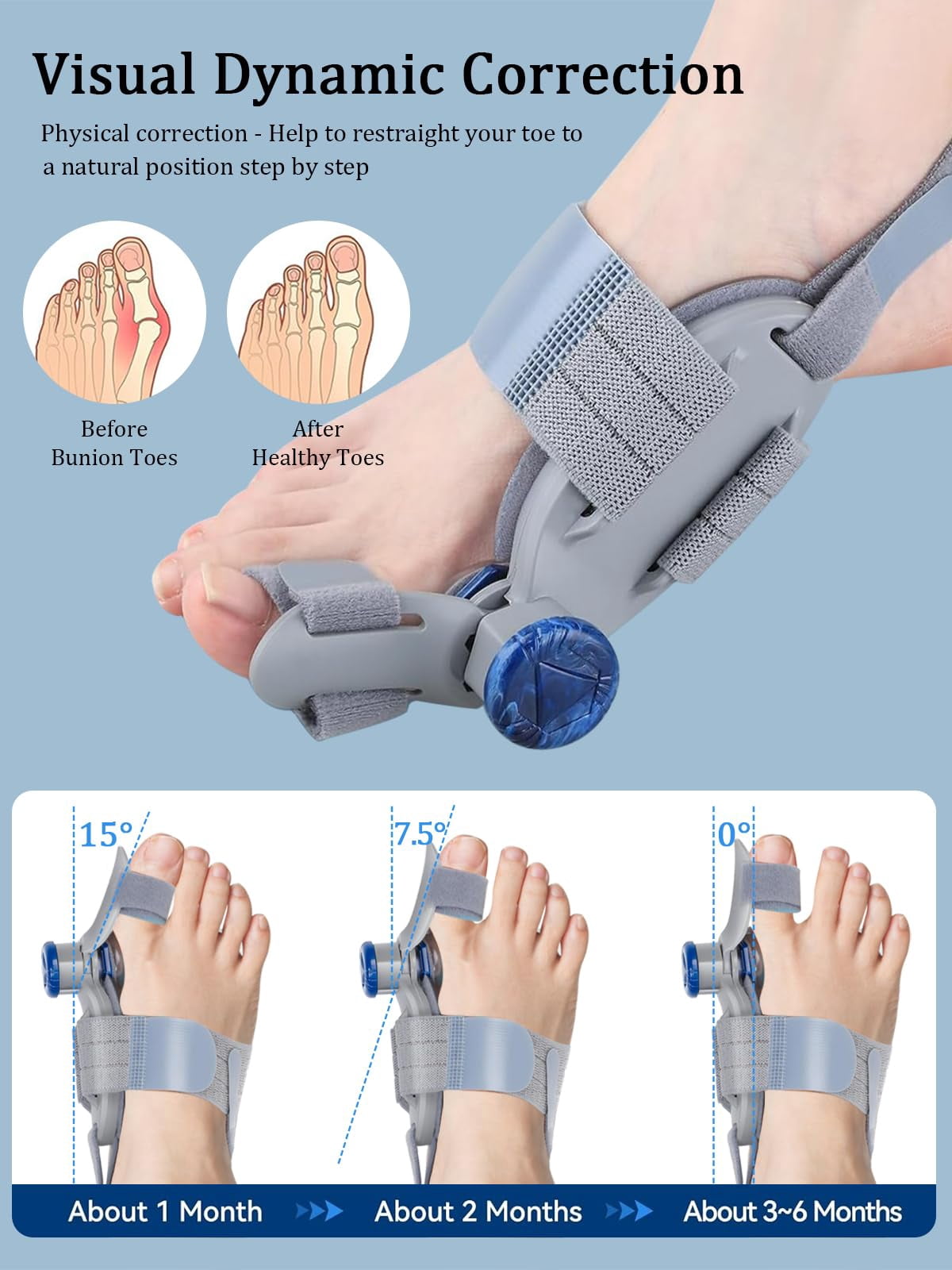 Pro V2 Adjustable Bunion Corrector Toe Straightener - Big Toe Pain Relief Support Splint for Men Women, One Size Fits All, Breathable Comfort