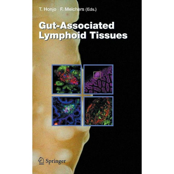 Current Topics in Microbiology and Immmu Gut-Associated Lymphoid Tissues, Book 308, (Hardcover)
