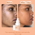 thumbnail image 3 of WishCare Vitamin C Face Serum with Niacinamide, Ferulic Acid & Botanical Extracts – Serum for All Skin Types, 30ml, 3 of 9