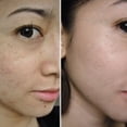 thumbnail image 5 of Pack 2 Jabones de Granada Natural 100 g. Ootness. Elimina el Acné y Corrige Manchas Ootness Kit SkinCare, 5 of 5
