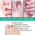 thumbnail image 3 of 30ml X3 Toenail Repair Liquid Soft Nail Repair Liquid Cleaning Repa, 3 of 3