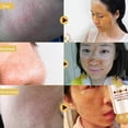 thumbnail image 5 of Tearing Deep Clean Honey Mask Dead Skin Clean Pores Shrink NEW, 5 of 5