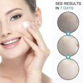thumbnail image 2 of Crema para eliminar manchas oscuras, alivia la cara, el cuerpo, la edad, pigmentación, cuidado de la piel, hidratante Facial antienvejecimiento, 2 of 5