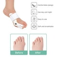 thumbnail image 4 of Pinkiou Bunion Corrector, Bunion Relief Socks Sleeves with Toe Separator Hallux Valgus Big Bone Toe Corrector Splint Toe Straightener Pain Relief Orthotics Feet Care, 4 of 11