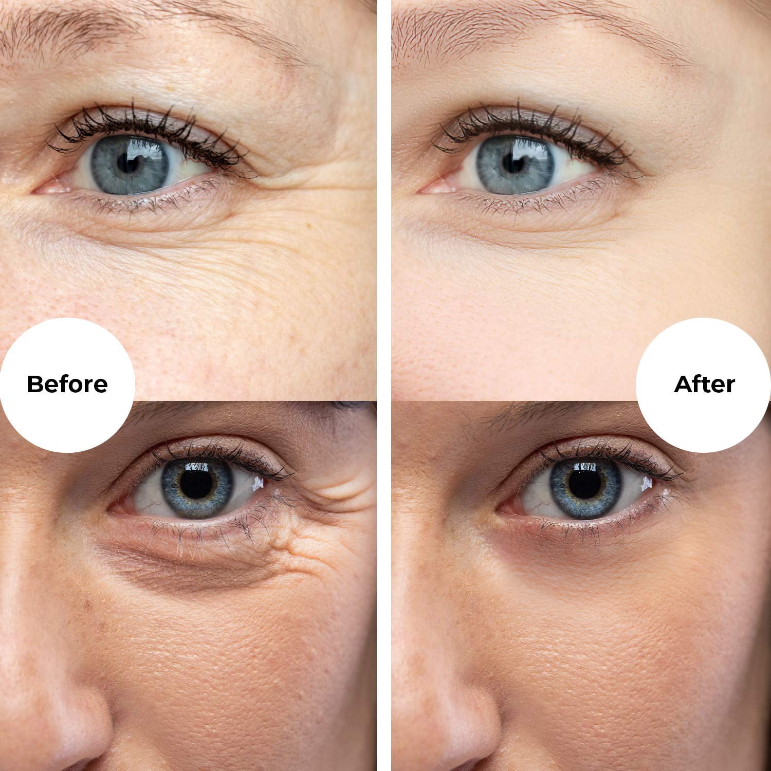 Buy Gle for Wrinkles, Fine Lines and Aging Spots AntiAging Skincare