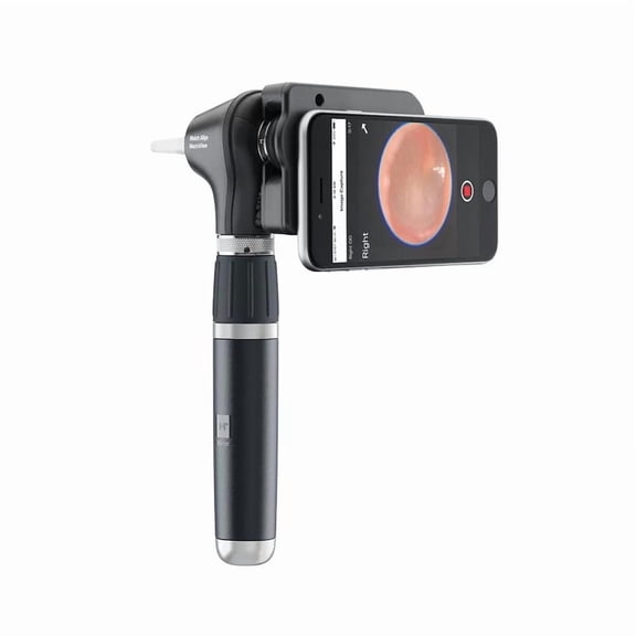KASHSURG Wel-ch- All-yn 3.5V Diagnostic Set with MacroView Plus Otoscope for iExaminer_IN_SSD178