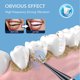 thumbnail image 2 of Set de limpieza dental ultrasónica Cepillo de dientes eléctrico Eliminador de sarro Regalo, 2 of 5