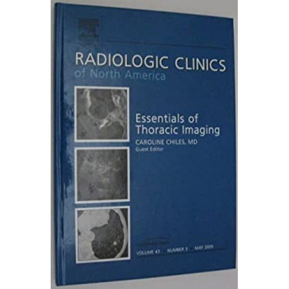 Pre-Owned Essentials of Thoracic Imaging, an Issue of Radiologic Clinics (Hardcover) 9781416027607