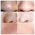 thumbnail image 2 of high qualityBlackhead Remover Serum With 100 Strips, Blackhead Remover Mask Peel Off Blackhead Mask 2 in 1 Green Tea Oil Blackhead Removal, 2 of 5