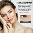 thumbnail image 6 of Niacinamide eye cream , Reduces the appearance of dark circles and fine lines around the eyes, moisturizes and moisturizes the skin around the eyes, 6 of 10