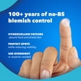 thumbnail image 5 of Noxzema Blemish Patches - Hydrocolloid Acne Pimple Patches with Niacinamide & Tea Tree Extract - 30 Count, 5 of 11