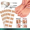 thumbnail image 3 of 100 piezas de pegatinas correctoras de uñas, parche corrector de uñas encarnadas, resistente al agua, tratamiento de paroniquia, herramienta de pedicura correctora de recuperación, 3 of 5