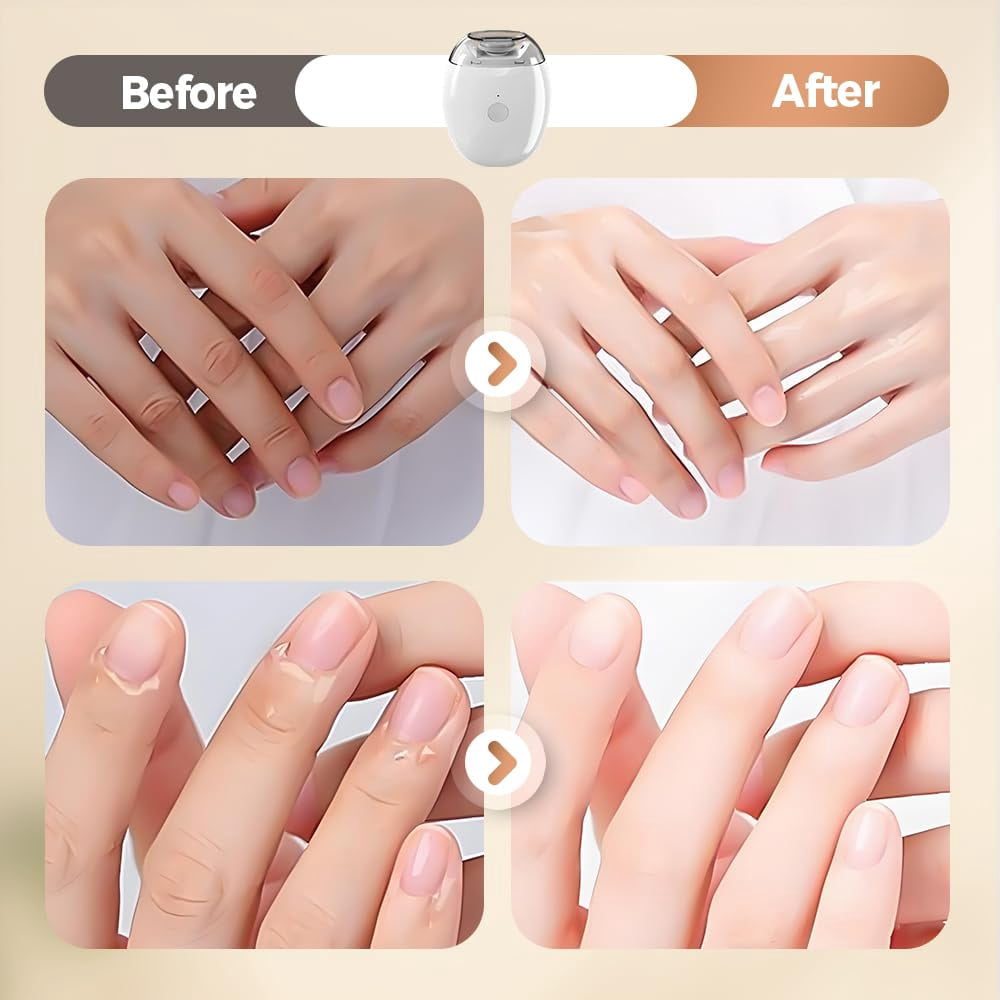 Universal Automatic Fingernail Grinder, 2026 New 3 in 1 Electric Nail Clipper, Automatic Nail Trimmer with LED Light and 3 Speeds, Electric Toenail Clippers for Seniors Adults