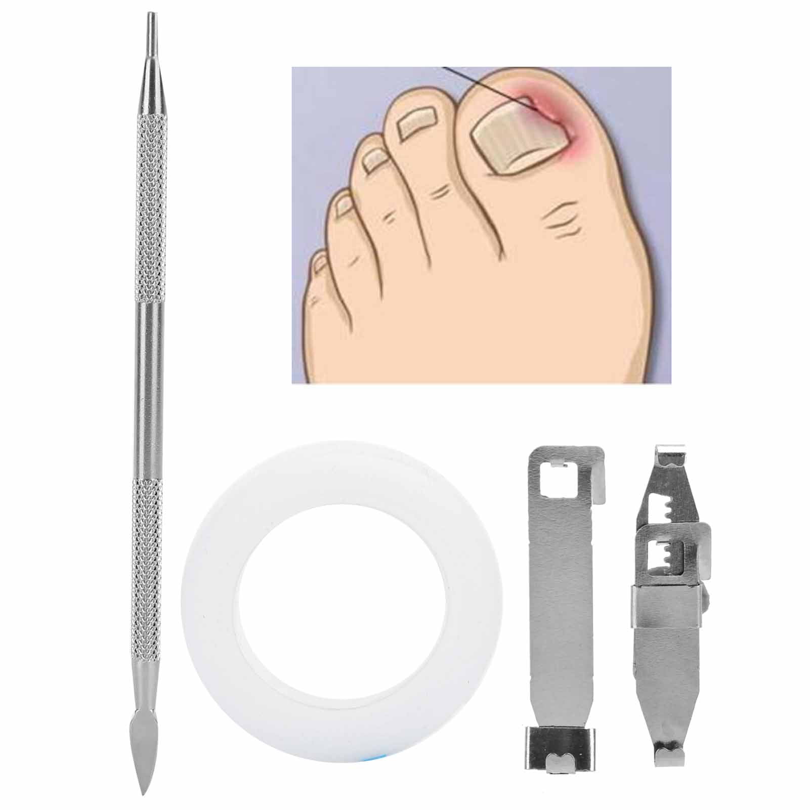 Ccdes Stainless Steel Ingrown Toenail Corrector Dead Skin Pusher Tape