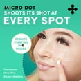 Dots for Spots Micro Dot Pimple Patches (Pack of 9) Niacinamide