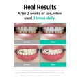 thumbnail image 2 of Pasta dental blanqueadora LiveOrals 80 g sin flúor para dientes sensibles, 2 of 6