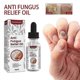 thumbnail image 3 of aceites Mardi Gras 2024, aceite de alivio, aceite reparador para uñas dañadas, aceite para aliviar la paroniquia, 10 ml Lucky_B, 3 of 5