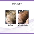 thumbnail image 4 of Zenagen Revolve Shampoo For Women | Supports Scalp Health & Appearance of Fuller, Healthier-Looking Hair, Developed for Fine & Visibly Thinning Hair,, 4 of 4