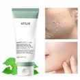 thumbnail image 2 of Suero de esencia de niacinamida Anua Peach al 70%, tónico, 30 ml, limpiador facial de quercetina y Houttuynia Cordata, 2 of 6