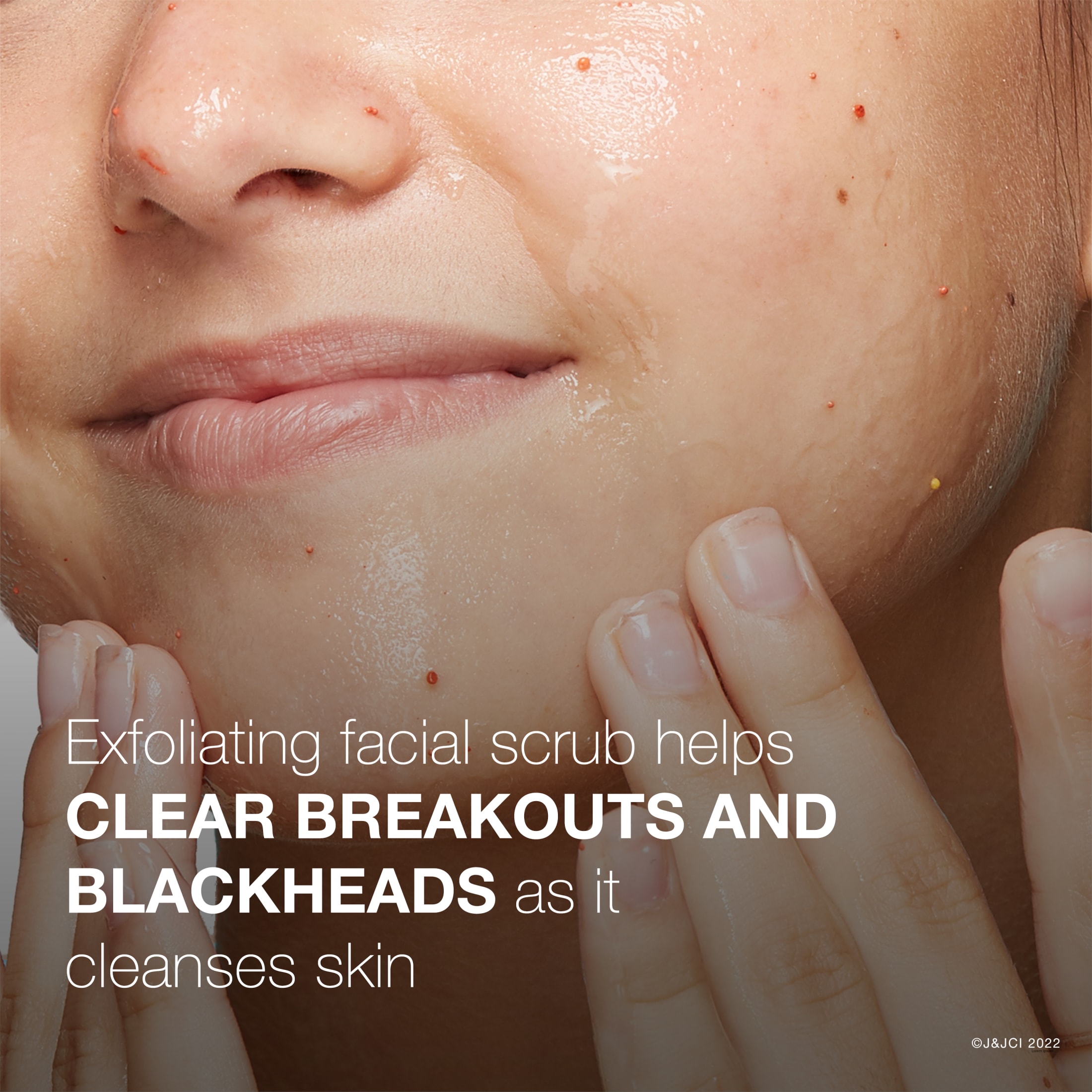 Neutrogena Oil-Free Acne Wash Pink Grapefruit Facial Scrub, 4.2 fl. oz - image 3 of 11