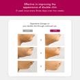 thumbnail image 3 of Anacis Double Chin Reducer Mask for Instant Face and Neck Lift Firm and Tighten Sagging Skin 5 Masks, 3 of 10