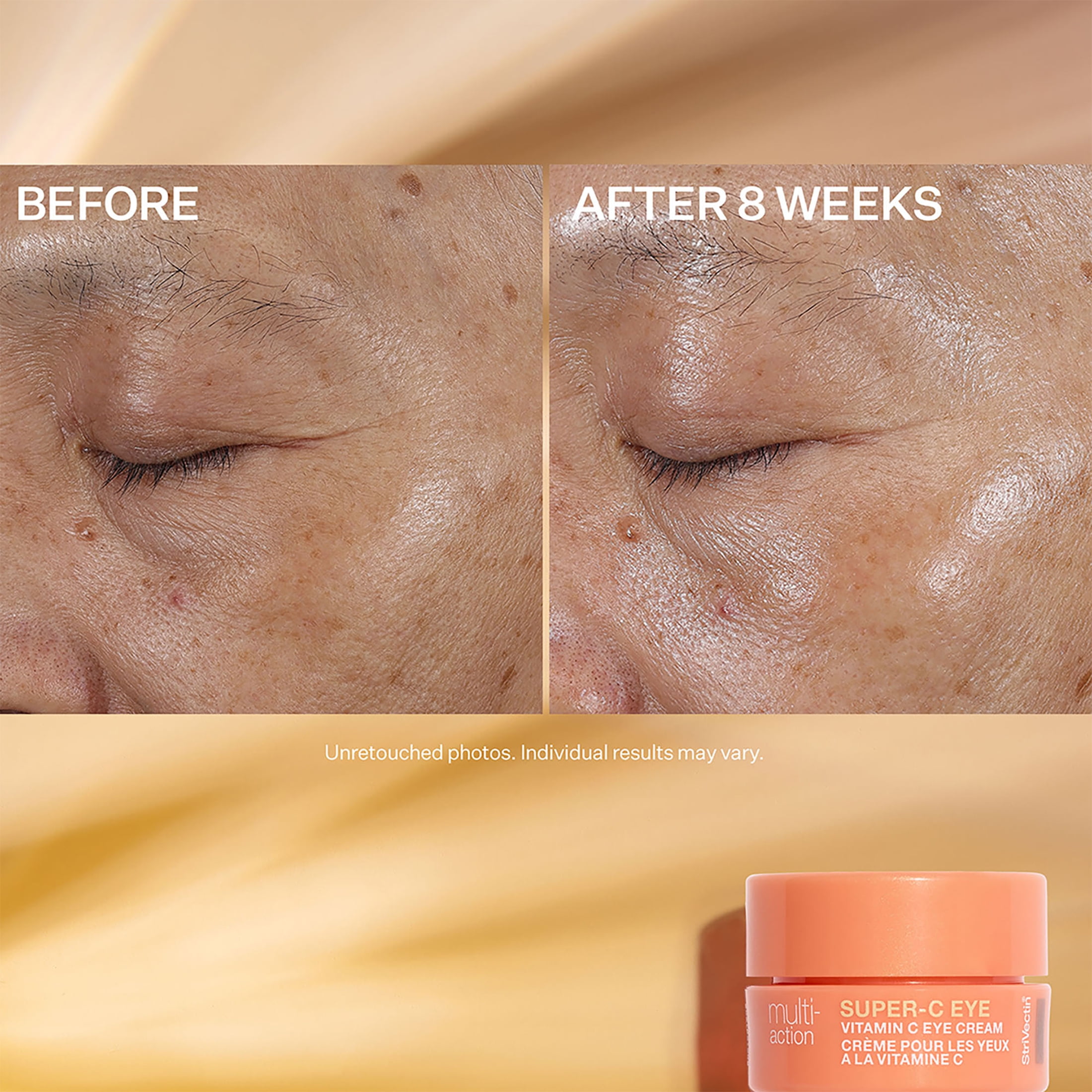 StriVectin Multi-Action Trio: Brighten & Restore Kit, 3 Pieces